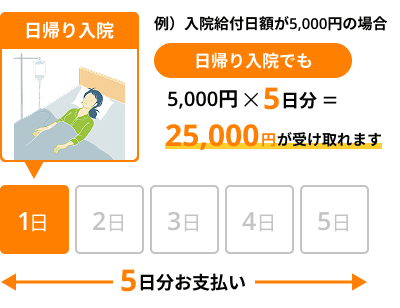 日帰り入院 入院給付金日額5,000円の場合:5日分の25,000円をお支払い